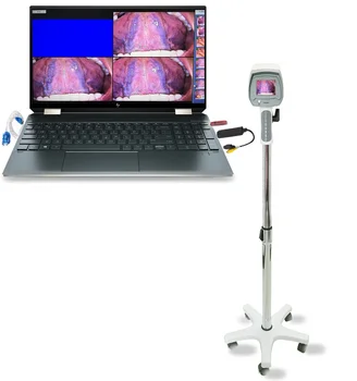Одобренный CE гинекологический портативный цифровой кольпоскоп
